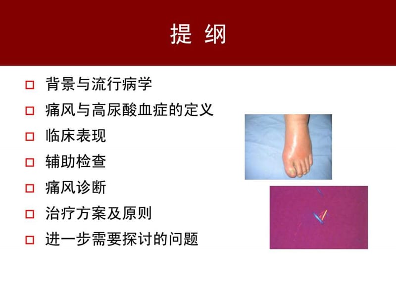 2013中国痛风临床诊治指南解读.ppt_第2页