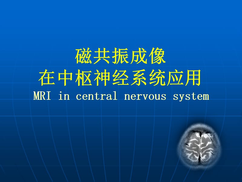 mri成像在中枢神经系统的应用ppt课件.ppt_第1页