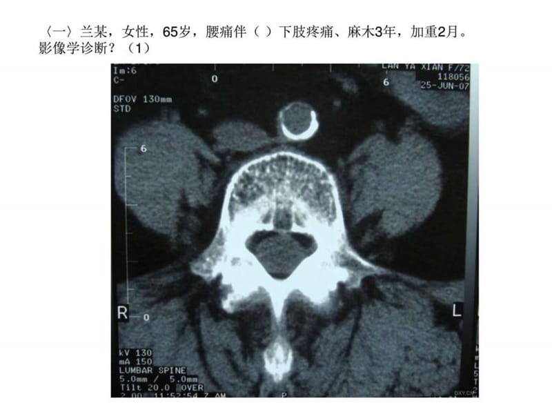 《丁香园影像阅片》PPT课件.ppt_第3页