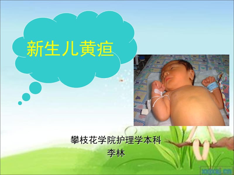 新生儿病理性黄疸ppt课件.ppt_第1页