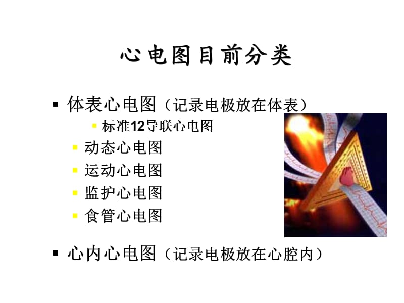 临床心电图分析ppt课件.ppt_第2页