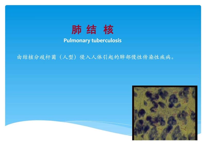 肺结核病人的护理教学课件(专业版).ppt_第3页