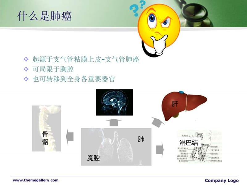 肺癌and先天性心脏病.ppt_第2页