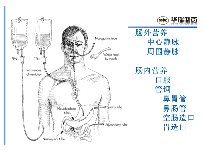 肠外营养配制转发ppt课件.ppt_第2页