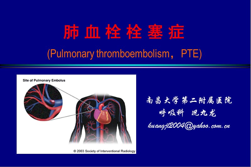 医学ppt--内科学肺栓塞教案.ppt_第1页