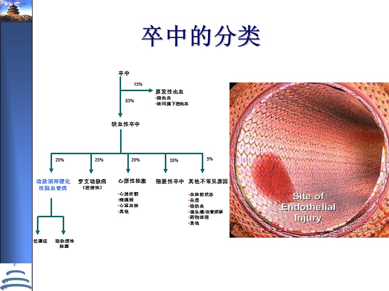 缺血性卒中的诊断策略王拥军ppt课件.ppt_第3页