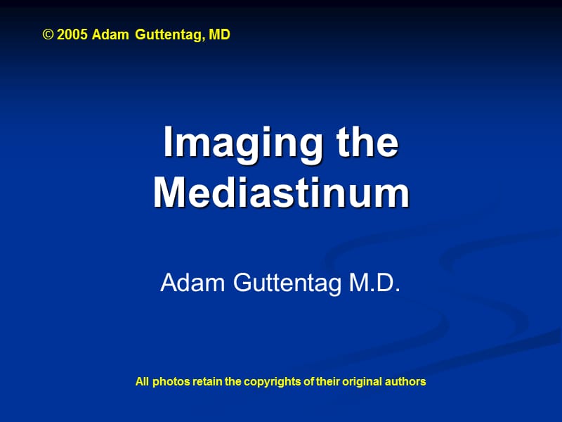 医学ppt--mediastinummodadam.ppt_第1页