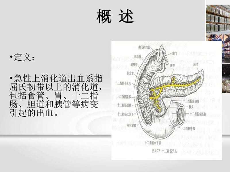 急性上消化道出血急诊诊治专家共识.ppt_第2页