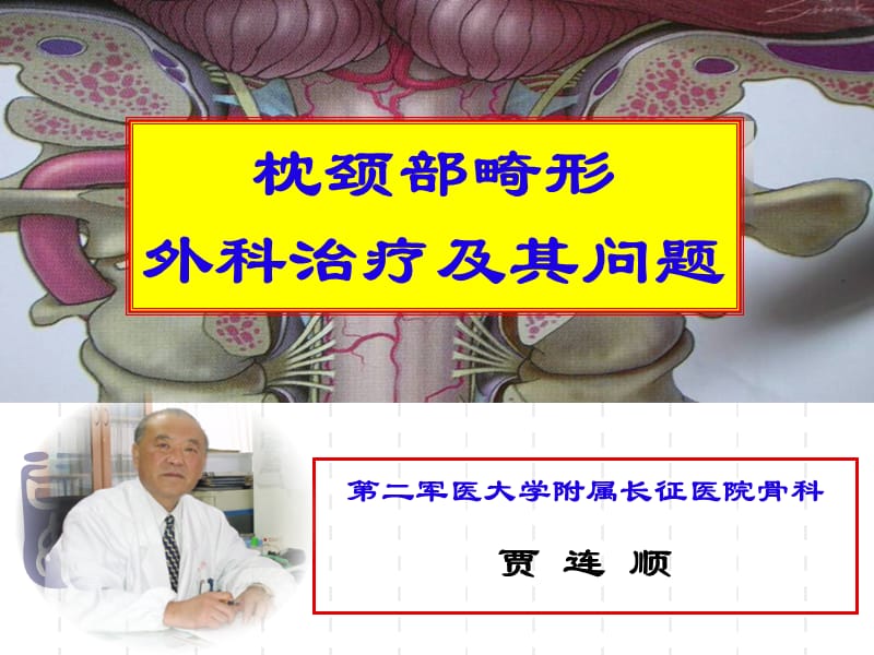 枕颈部发育畸形简略版白底板ppt课件.ppt_第1页