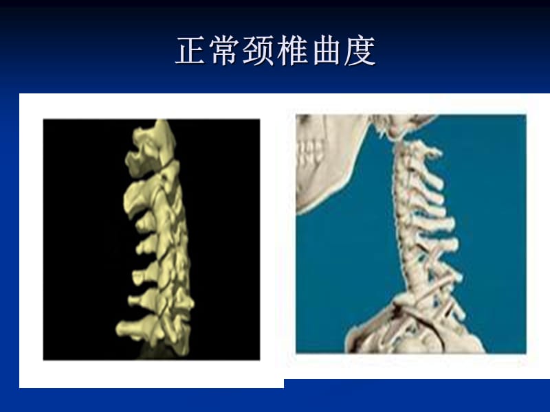 颈椎病预防与保健PPT课件.ppt_第3页