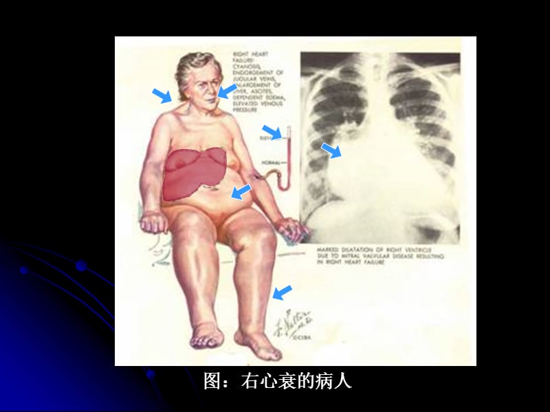 病理生理学第一二章绪论与疾病概论PPT课件.ppt_第3页