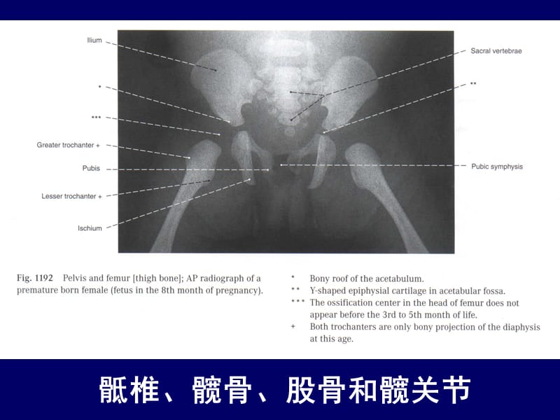 人体断层解剖学-下肢的断层解剖PPT课件.ppt_第3页