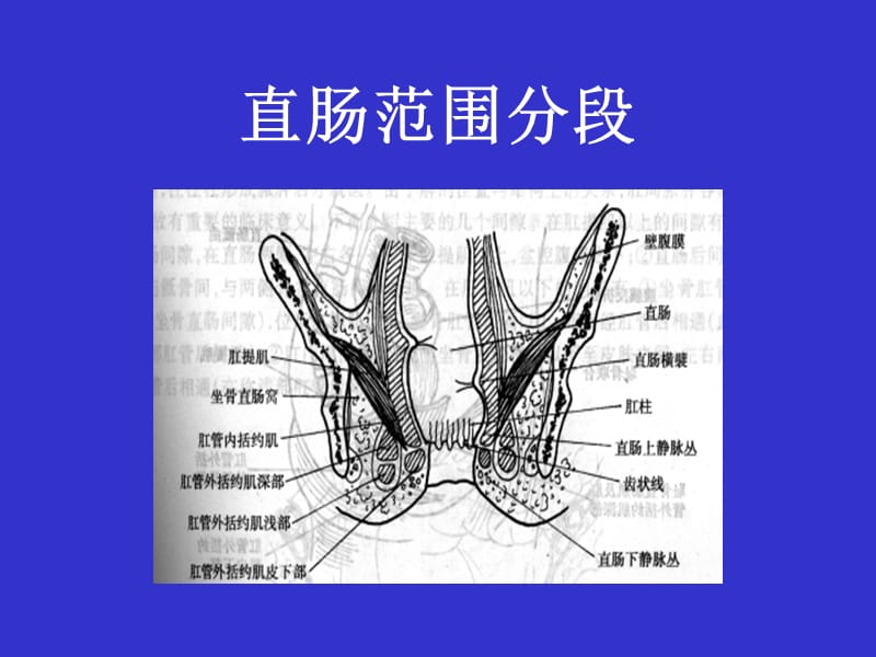 结直肠肛管疾病PPT课件.ppt_第3页