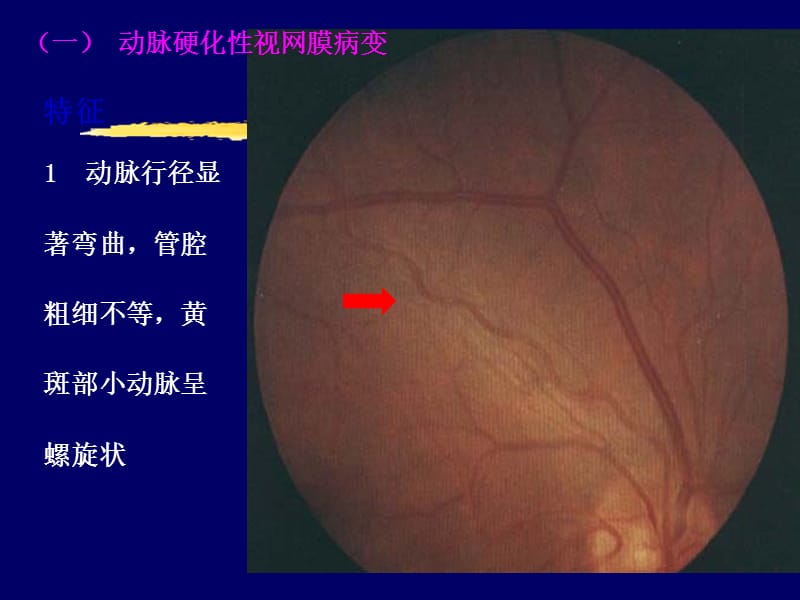 全身疾病的眼部表现PPT课件.ppt_第3页