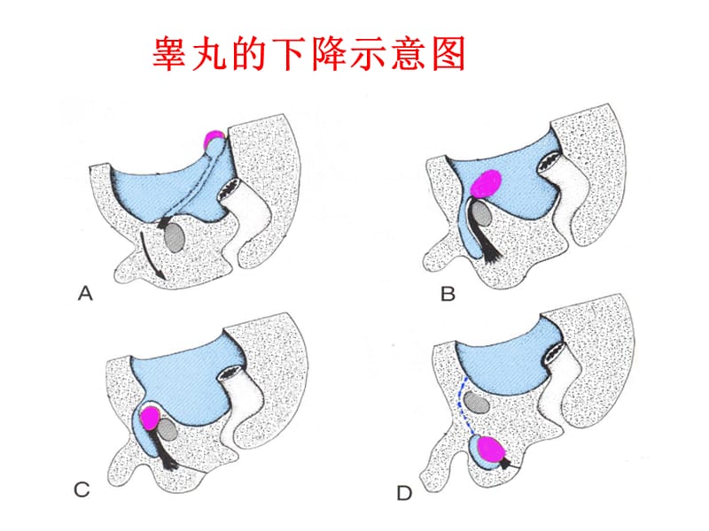 男性生殖系统超声诊断PPT课件.ppt_第3页