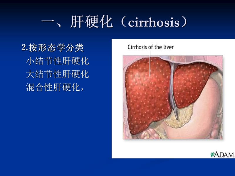 肝脏弥漫性疾病PPT课件.ppt_第3页