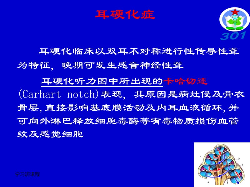 听力学习班课程-聋病的临床听力学特点分析.ppt_第3页