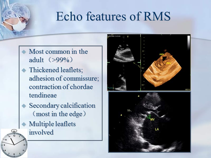 心脏超声波诊断技术及二尖瓣成形术（英文）.ppt_第3页