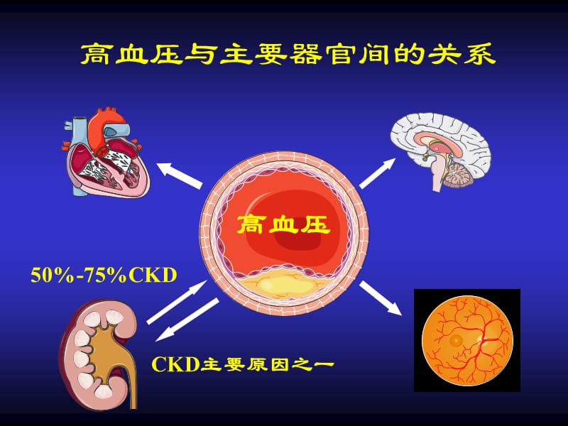 高血压合并肾损害的处理.ppt_第3页