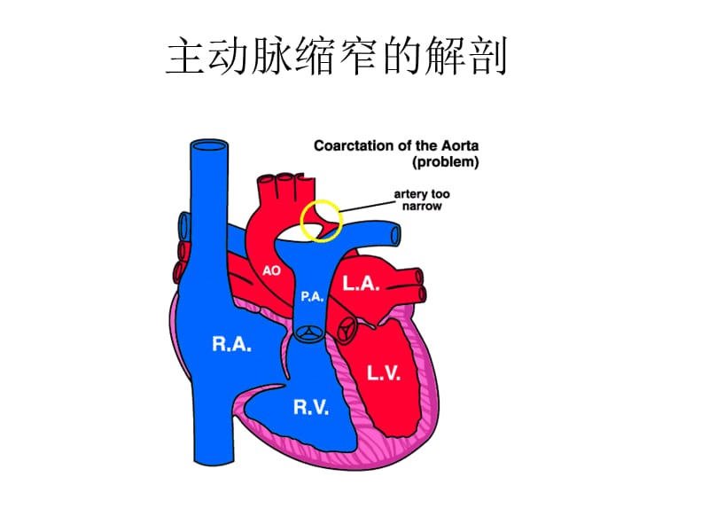 结构性心脏病介入器械研制现状.ppt_第3页