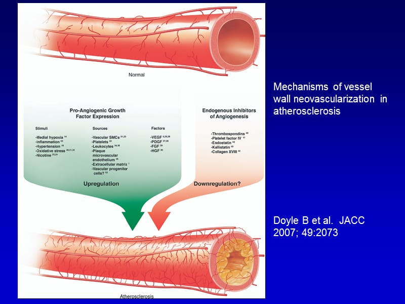 超声声学造影评价颈动脉粥样硬化斑块新生血管形成及稳定性（英文）.ppt_第2页