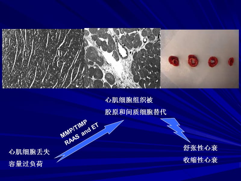 心力衰竭发生及进展的新视点_唐熠达.ppt_第3页