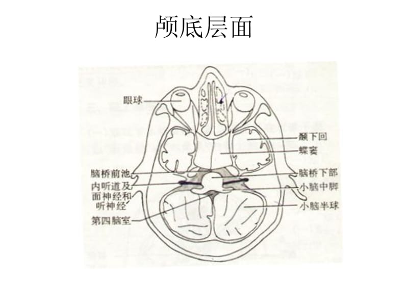 脑－头颅CT示意图-影像学课件.ppt_第2页