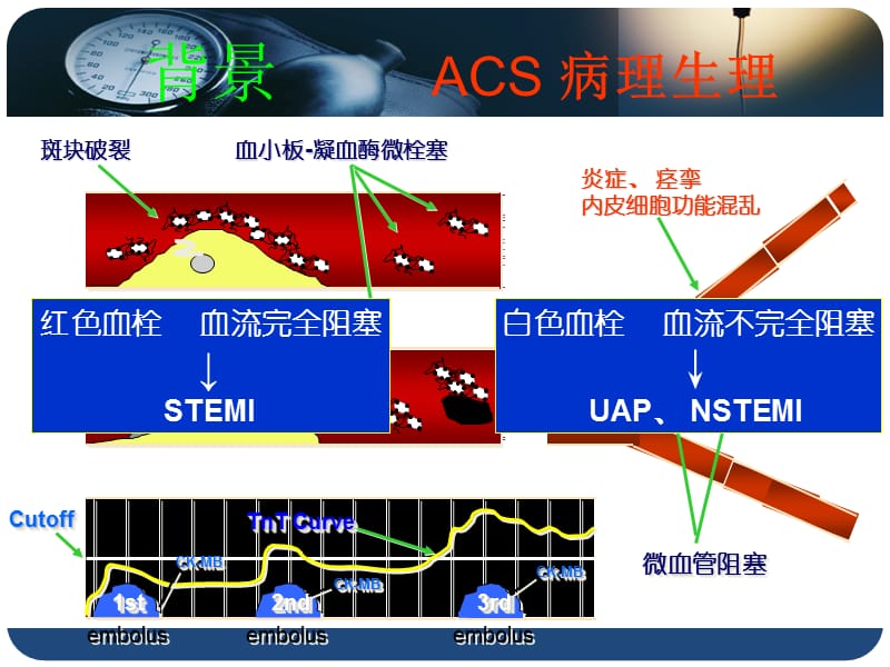 替罗非班在ST段抬高型心肌梗死急诊介入治疗中的应用研究.ppt_第3页