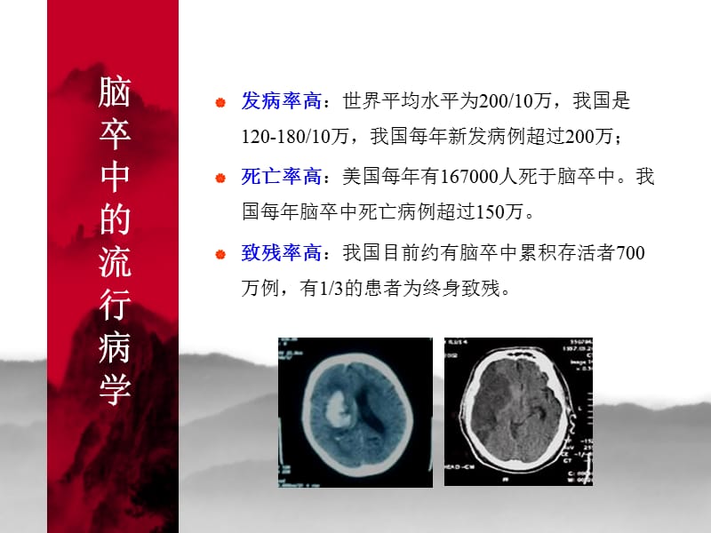 高血压与脑卒中的预防.ppt_第2页