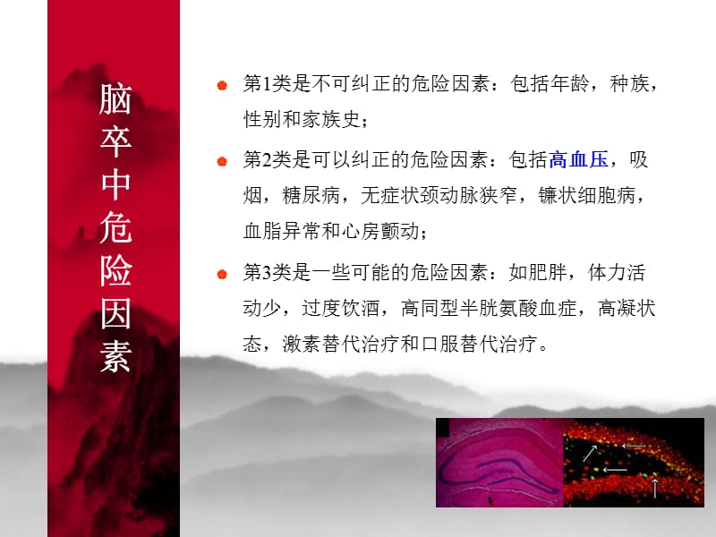 高血压与脑卒中的预防.ppt_第3页