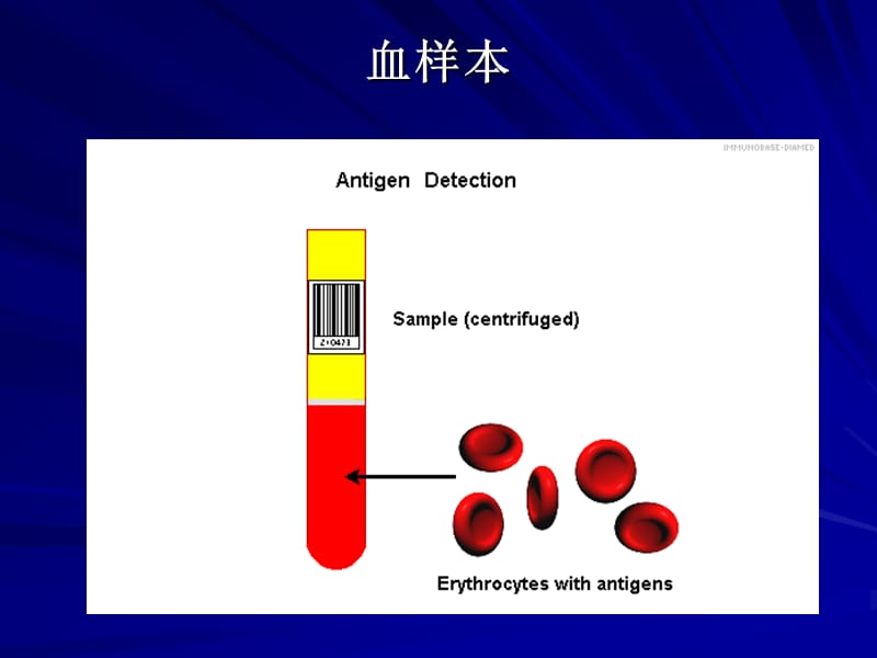 ABO血型鉴定试验.ppt_第1页