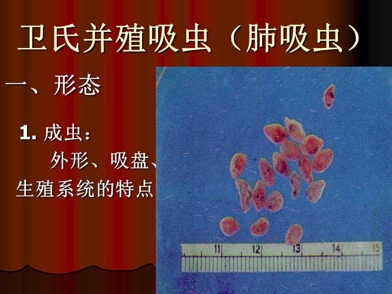 卫氏并殖吸虫(肺吸虫).ppt_第2页