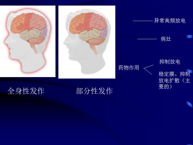 临本：第16章抗癫痫药和抗惊厥药.ppt_第3页