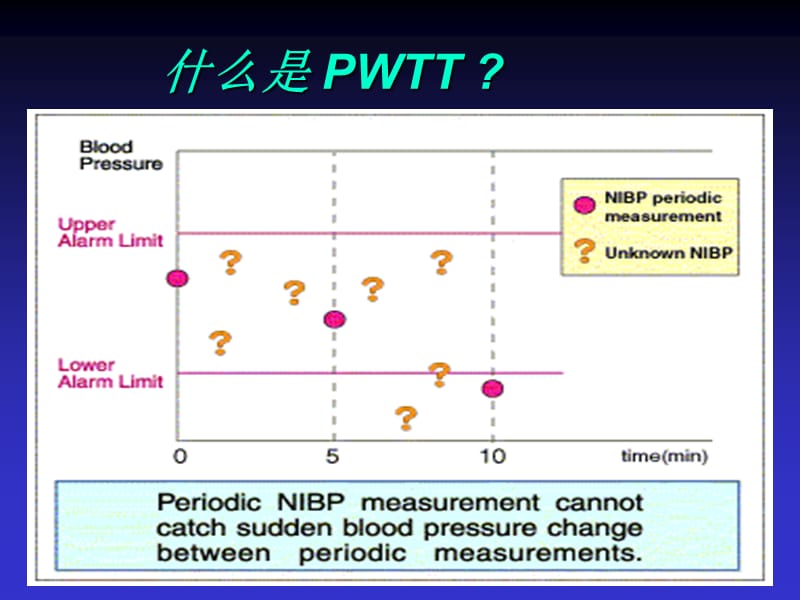 PWTT脉搏波传递时间.ppt_第2页