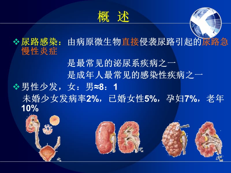 尿路感染护理非常全面.ppt_第3页