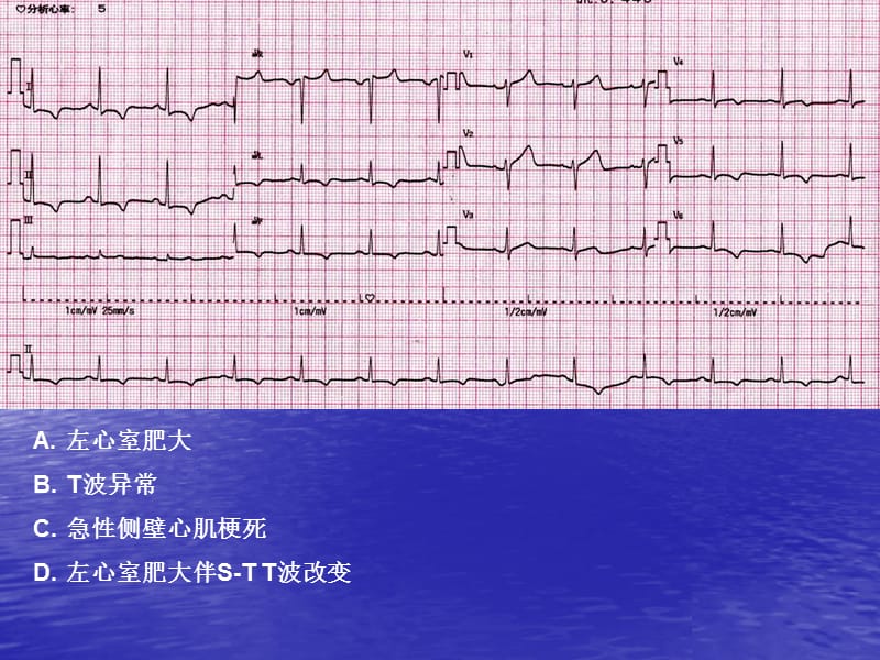 心电图考试练习.ppt_第2页