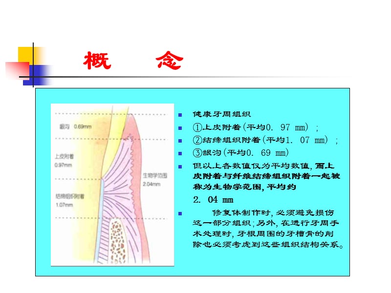 口腔修复学.ppt_第3页