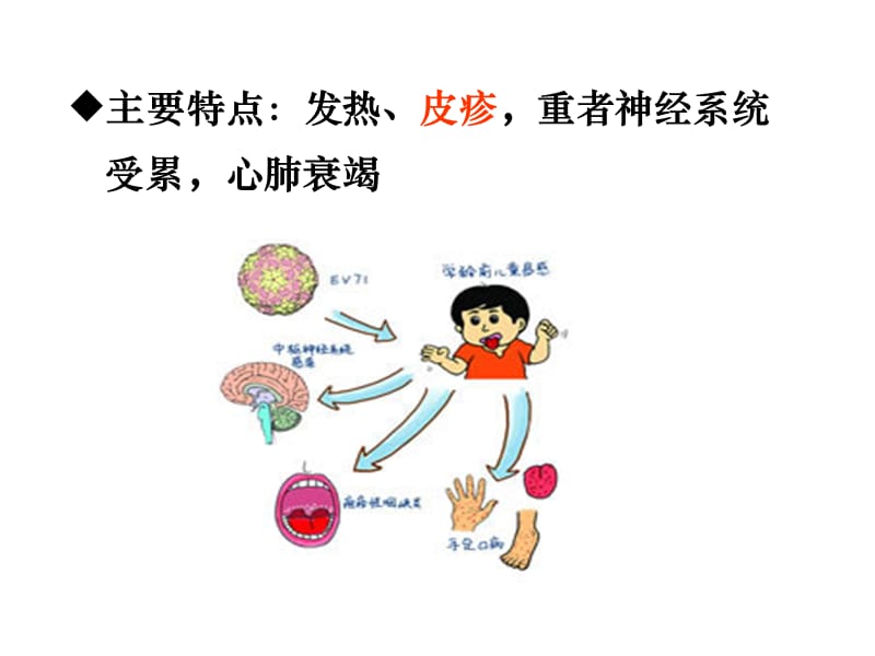 EV71感染的诊断与治疗.ppt_第3页