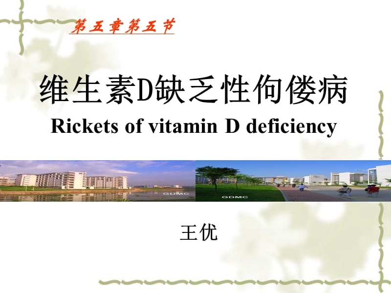 Rickets of VitD Deficiency非临床.ppt_第1页