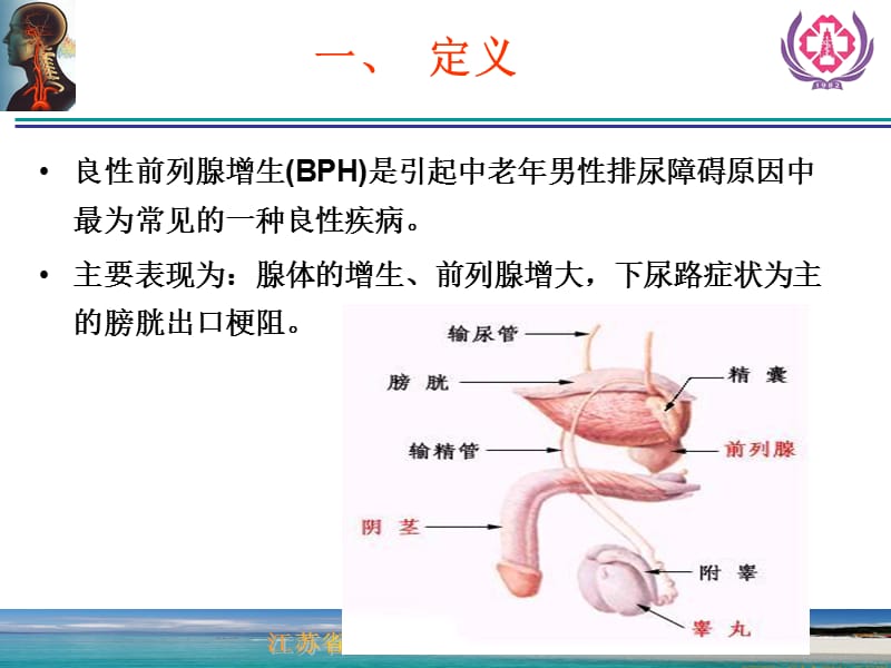 前列腺增生症的诊断治疗.ppt_第2页