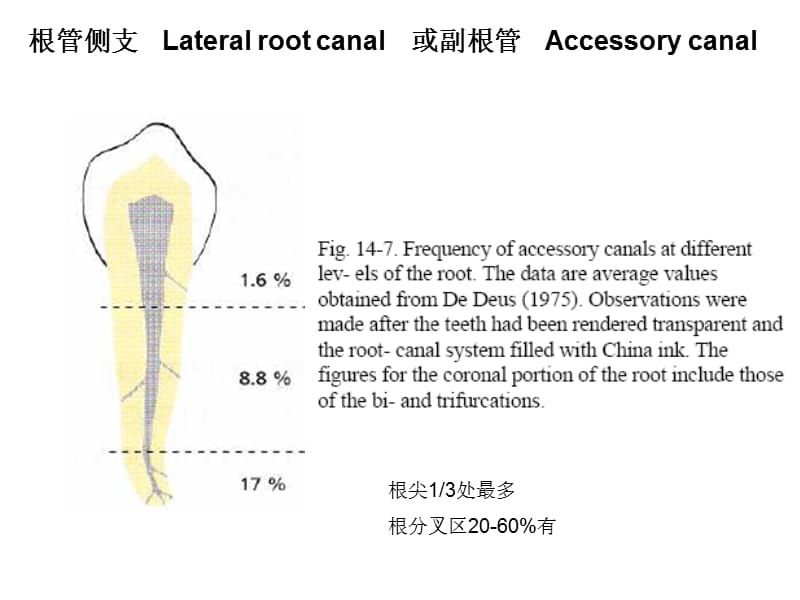 chapter14,牙周牙髓联合病变.ppt_第2页