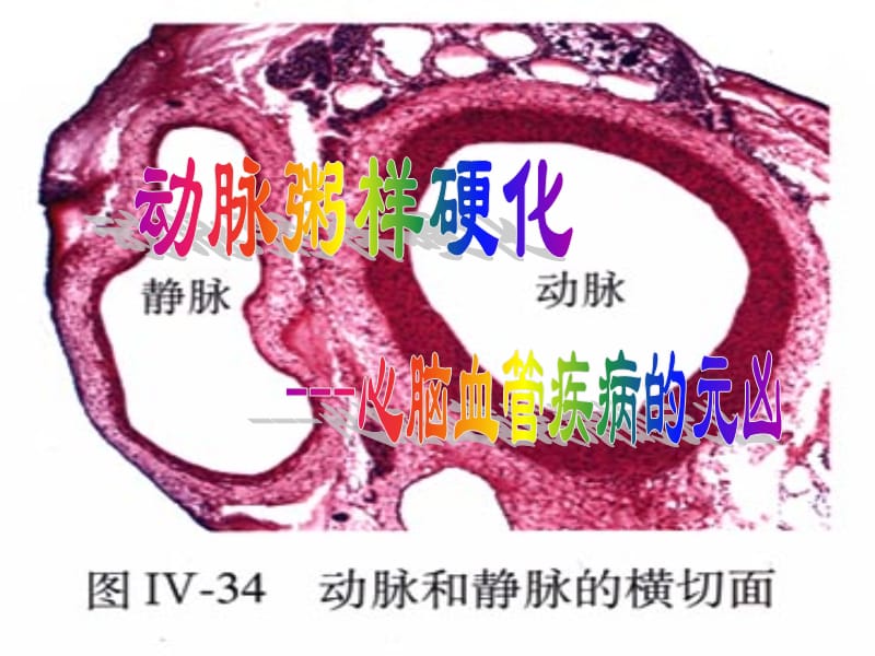 心脑血管的预防.ppt_第3页