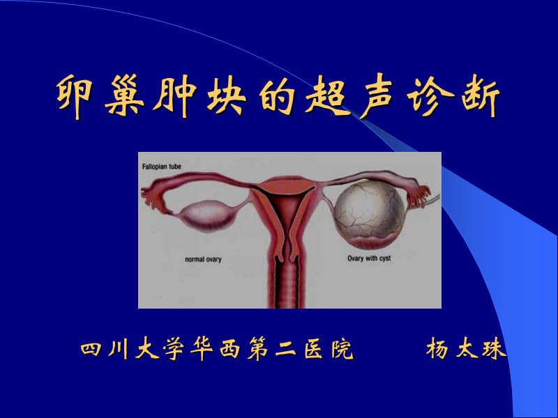 卵巢肿块的超声诊断杨太珠华西.ppt_第1页