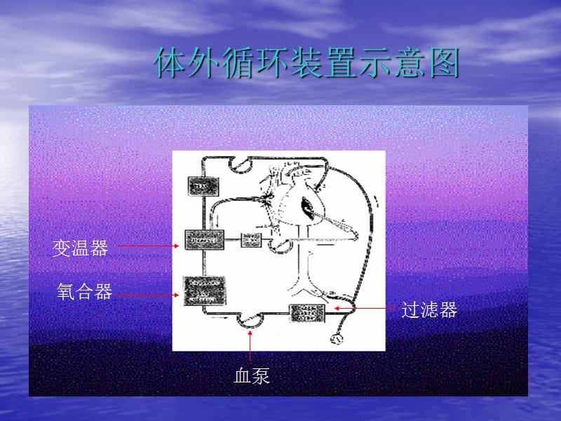 心脏疾病2.ppt_第3页