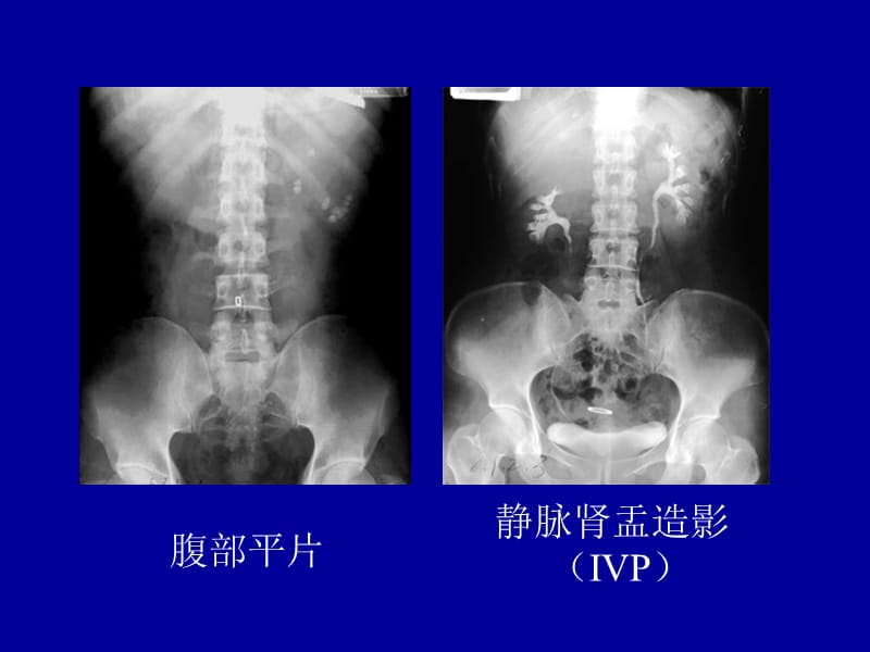 泌尿(7).ppt_第3页