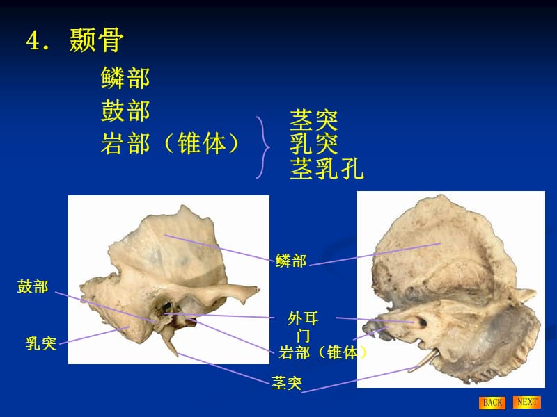 耳-颞骨病变的CT诊断鼻窦.ppt_第3页