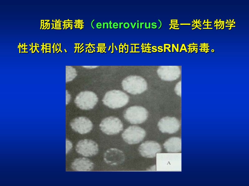 肠道病毒山东大学医学院赵蔚明教授.ppt_第2页