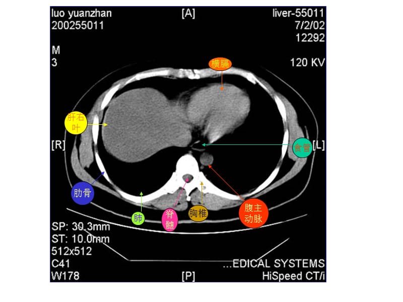 腹部CTppt课件.ppt_第1页