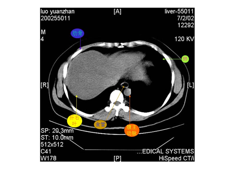腹部CTppt课件.ppt_第2页