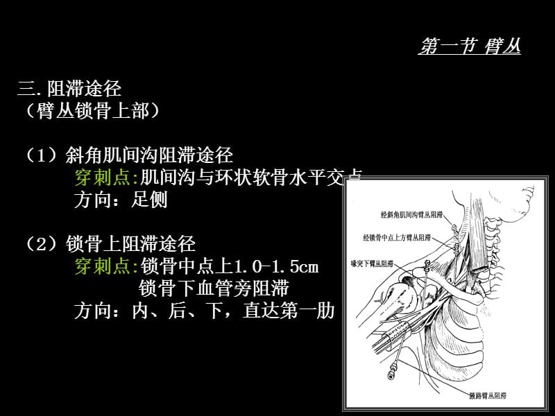 臂、腰、骶丛阻滞定位.ppt_第3页